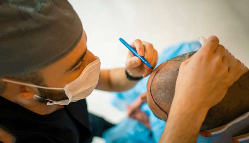 It is a comprehensive course of theory and practice to start your own hair transplant practice with recent advances in hair transplantation.